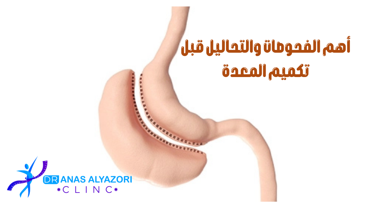 الفحوصات والتحاليل قبل تكميم المعدة