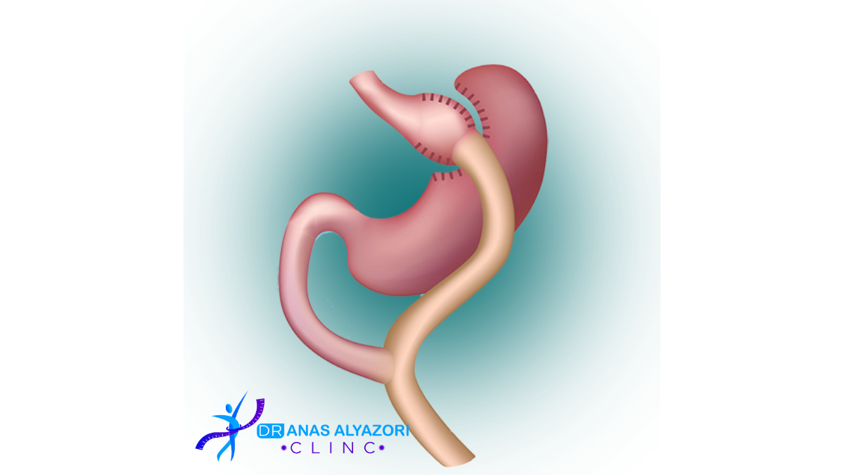 عمليات تحويل المسار